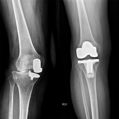 Blank 2 Grids Collage (1)